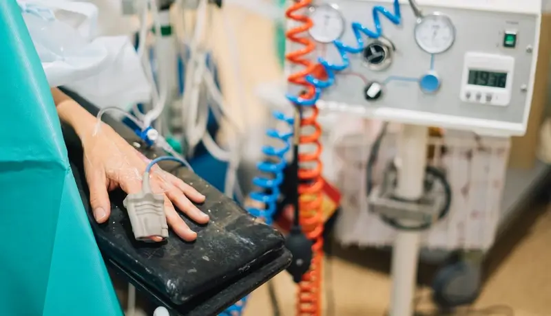 A patient's hand connected to a pulse oximeter and surrounded by medical equipment in an intensive care setting.